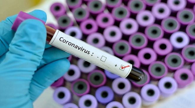 30 κρούσματα Covid-19 στην Κρήτη