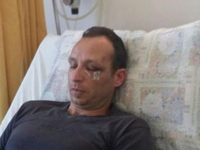 &Sigma;&tau;&omicron; &Epsilon;&phi;&epsilon;&tau;&epsilon;ί&omicron; &Chi;&alpha;&nu;ί&omega;&nu; &alpha;&nu;&alpha;&beta;&iota;ώ&nu;&epsilon;&iota; &omicron; &xi;&upsilon;&lambda;&omicron;&delta;&alpha;&rho;&mu;ό&sigmaf; &tau;&omicron;&upsilon; &gamma;&iota;&alpha;&tau;&rho;&omicron;ύ &Delta;&eta;&mu;ή&tau;&rho;&eta; &Mu;&alpha;&kappa;&rho;έ&alpha;